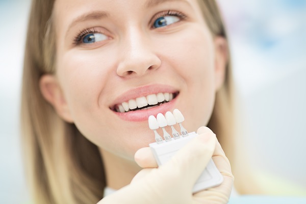 Dental Veneers and Dental Laminates Beaverton, OR