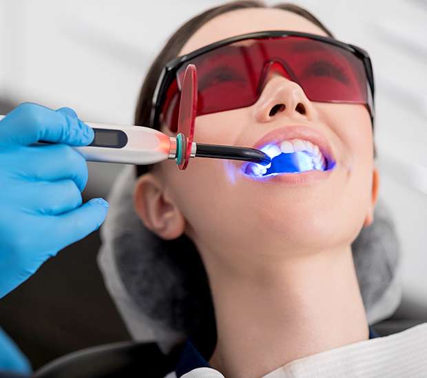 Beaverton Professional Teeth Whitening