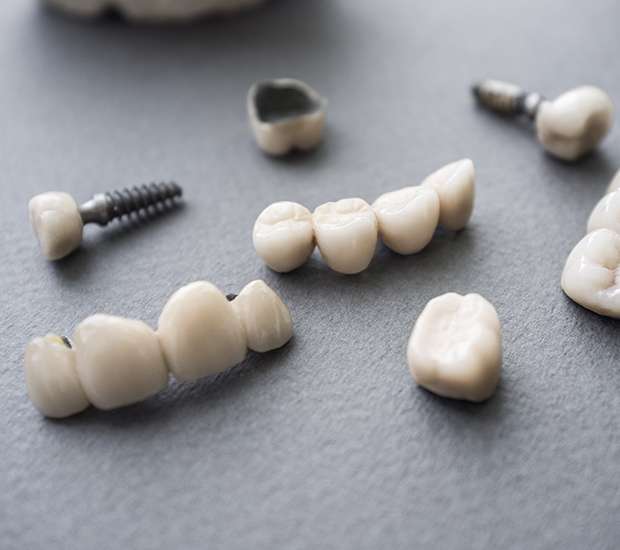 Beaverton The Difference Between Dental Implants and Mini Dental Implants